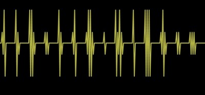 78ekg.jpg